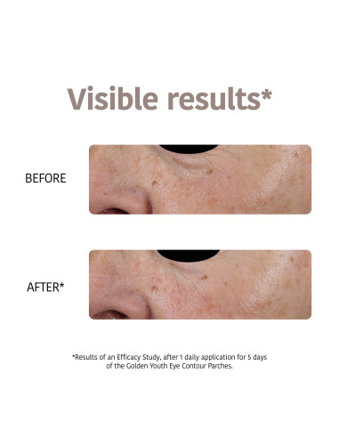 IROHA NATURE Patches - mask...