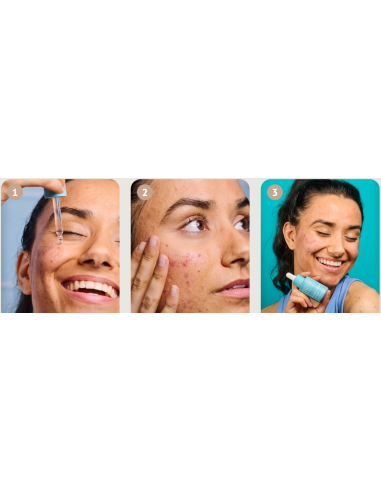 IROHA NATURE ACNE PRONE seerum...